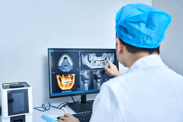 Best Knocked-Out Tooth (Avulsed Tooth) Treatment in Upper Lake, CA