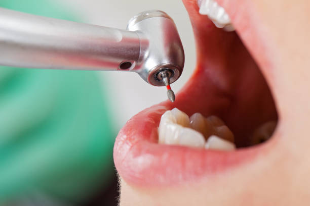 Best Emergency Denture Repair in Upper Lake, CA